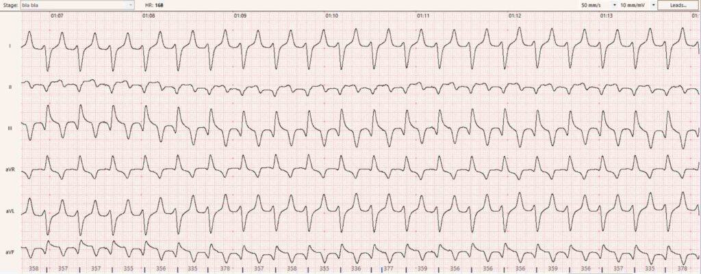 aritmii la caini si pisici