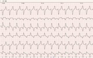aritmii la caini si pisici